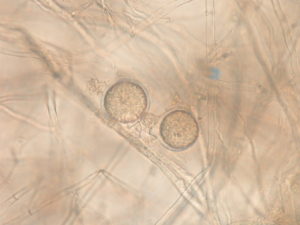 Fig. 1. Phytophthora micrographs. A. zoosporangia