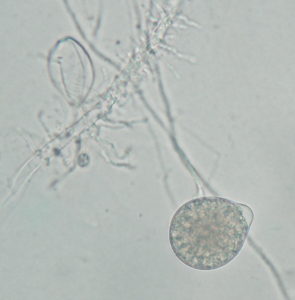 Phytophthora micrographs B. oospore Photos by Janna Beckerman